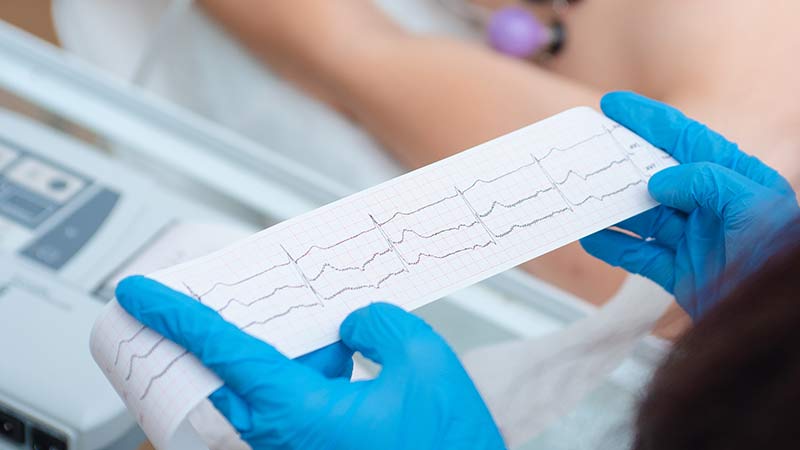 EKG und Herzlabor – richtig gemacht retten sie Leben!